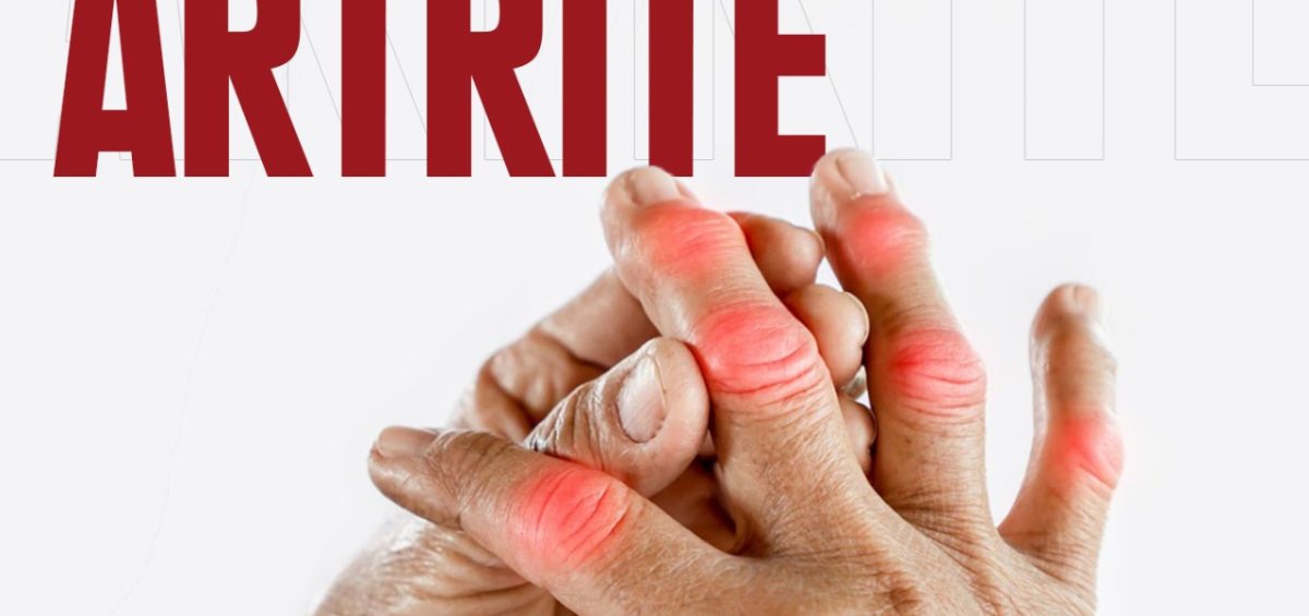 a imagem mostra mãos juntas com manchas vermelhas nas articulações, indicando inflamações. A palavra "Artrite" está escrita no canto esquerdo superior.