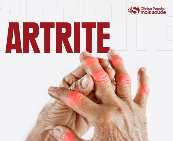 a imagem mostra mãos juntas com manchas vermelhas nas articulações, indicando inflamações. A palavra "Artrite" está escrita no canto esquerdo superior.