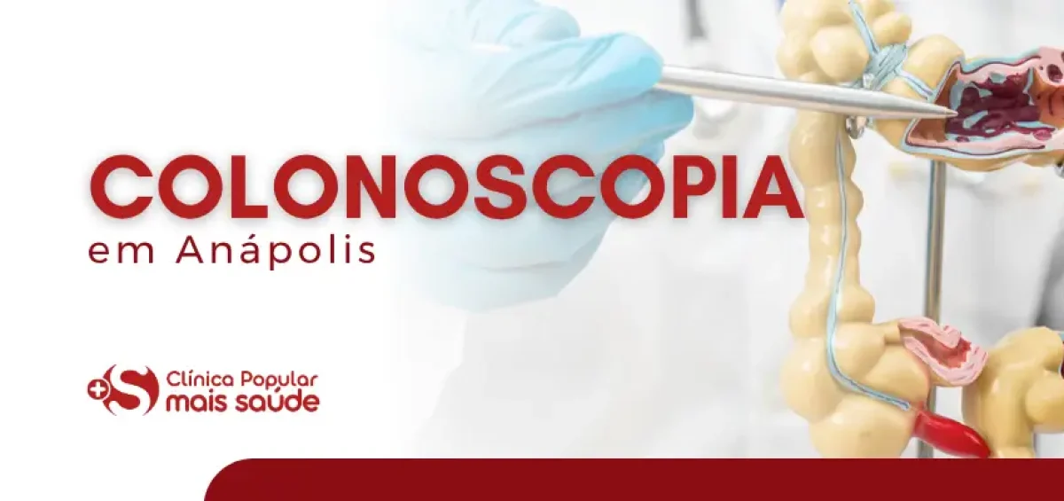 Exame de Colonoscopia em Anápolis