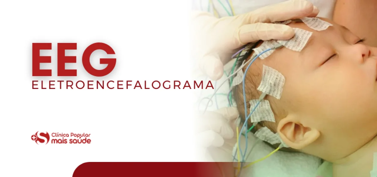 eletroencefalograma realizado em anápolis na clinica popular mais saude